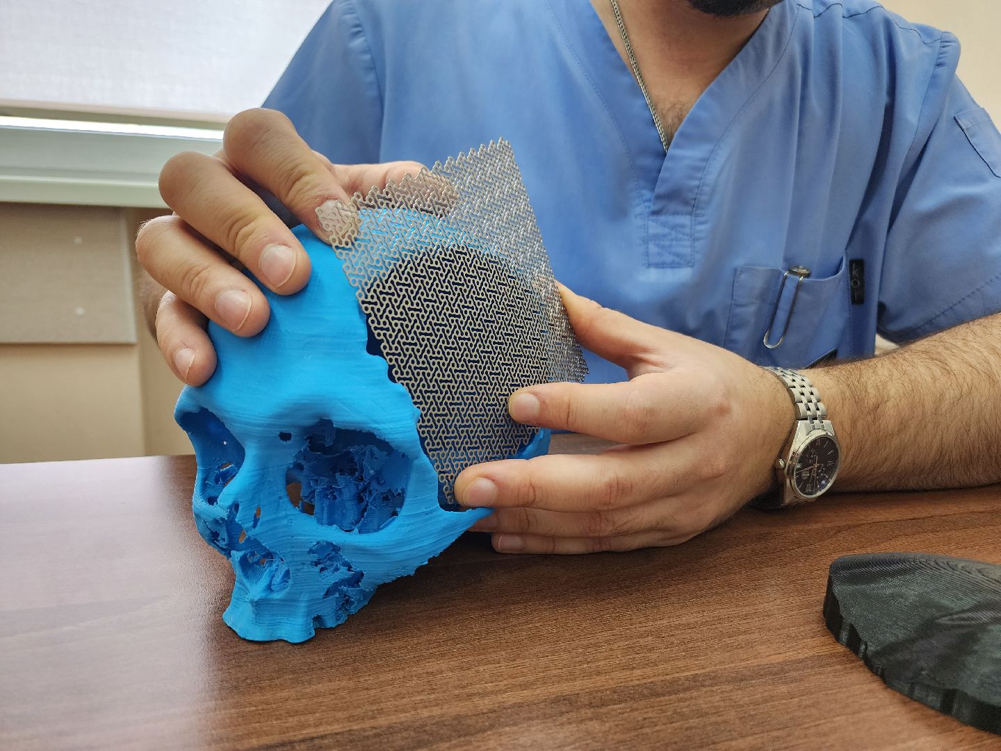 Красногорск, Врачи, Имплант, Череп, Операция,