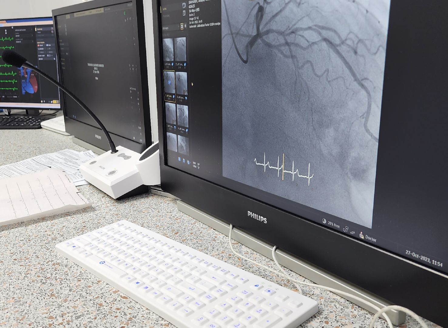 Медицина, первая операция, Кардиостимуляторы, фбуз мсч №9 фмба россии, сосудистый центр, Дубна,