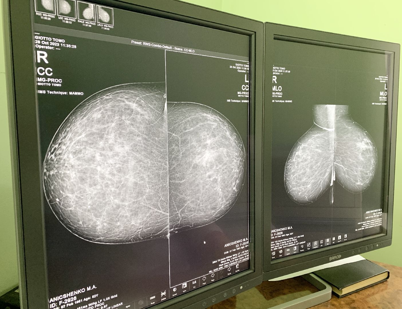 Балашиха, Подмосковье, Медицина, Онкология, Рак молочной железы, День ранней диагностики,