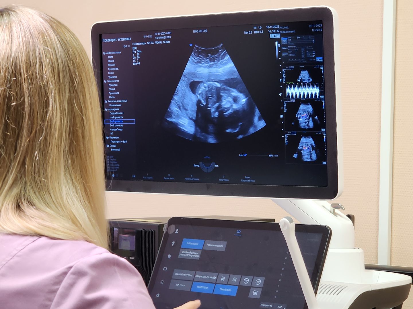 роддом, серпухов, медтехника, новое оборудование, аппарат узи,