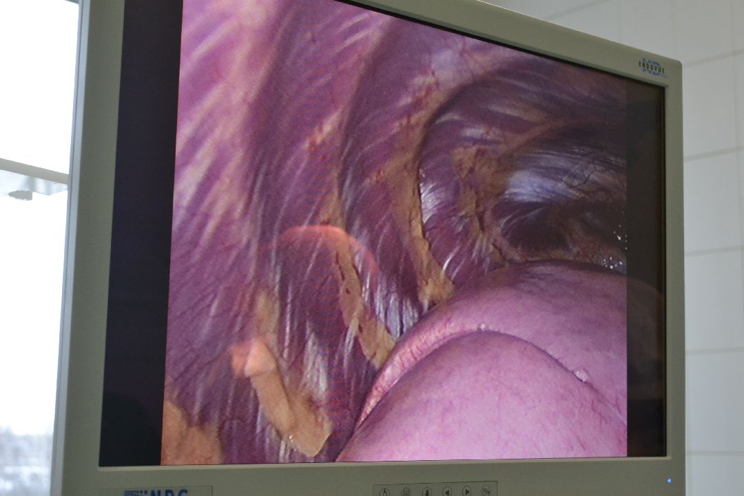 Балашиха, Балашихинская областная больница, медучреждения, здоровье, врачи, операции, Валерий Файзуллаев, Сослан Хадонов, грудь сапожника