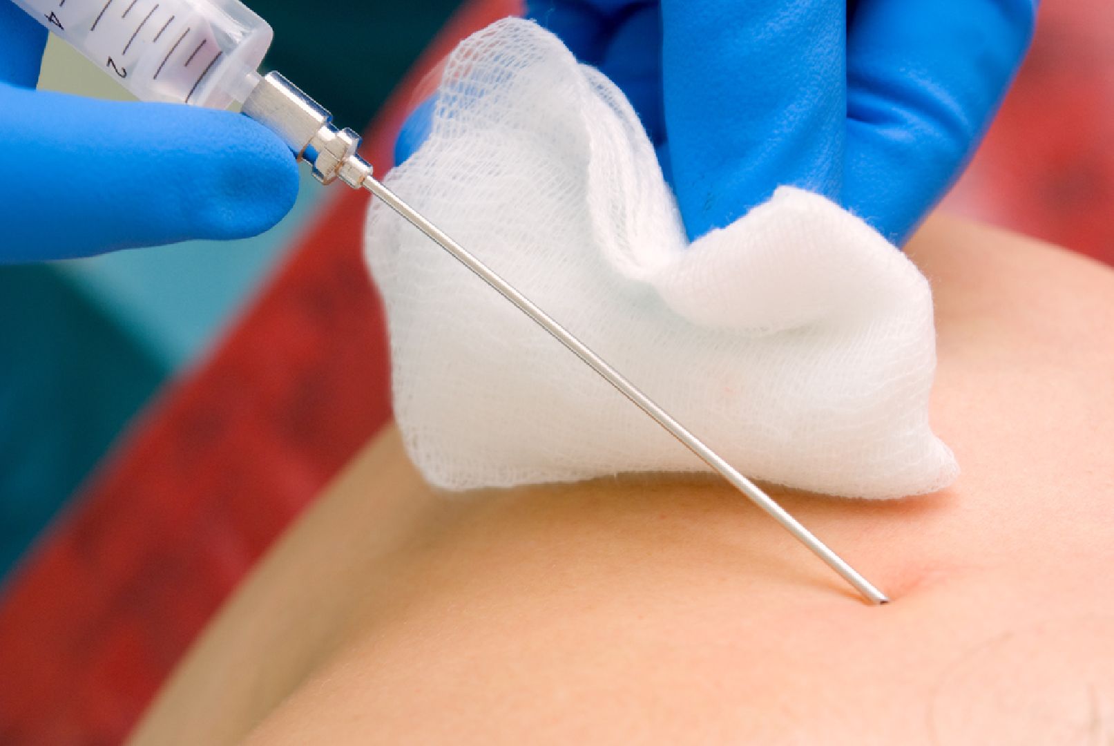 Звенигород, Здоровая кожа, Медицина, Профилактика и лечение онкологии,