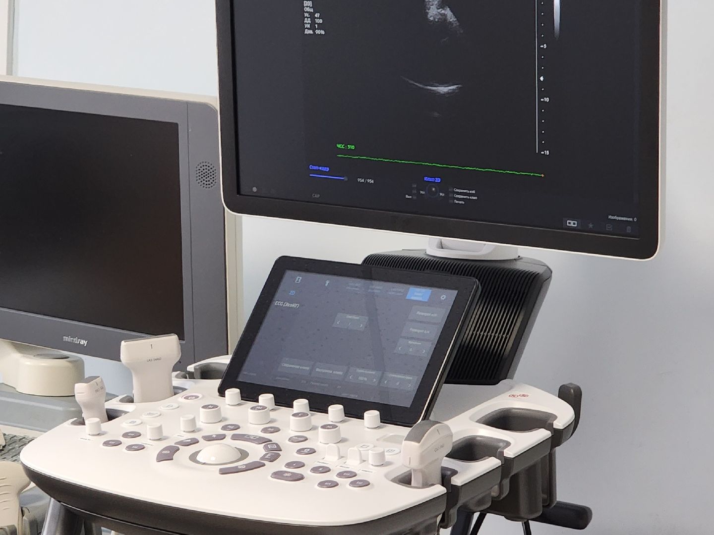 оборудование, узи, щёлково, медицина, больница,