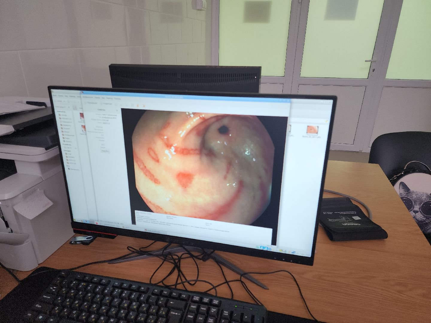 коломна, медицина, новое оборудование,