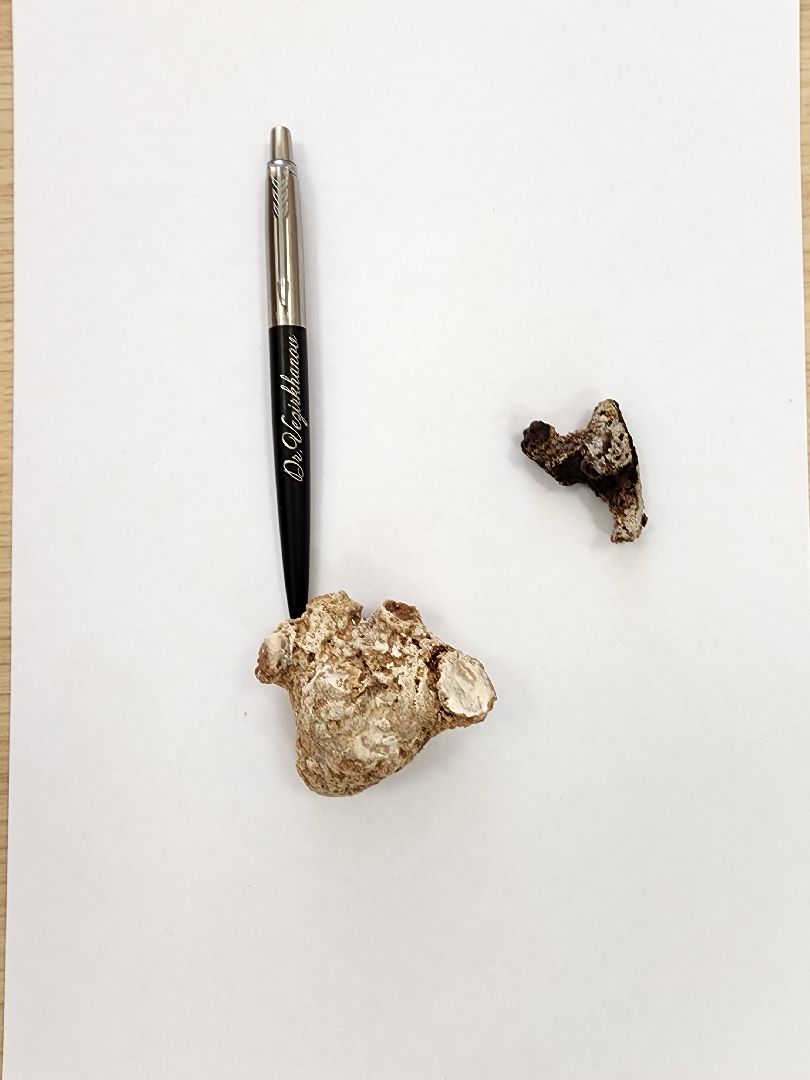 медицина, урология, операции,