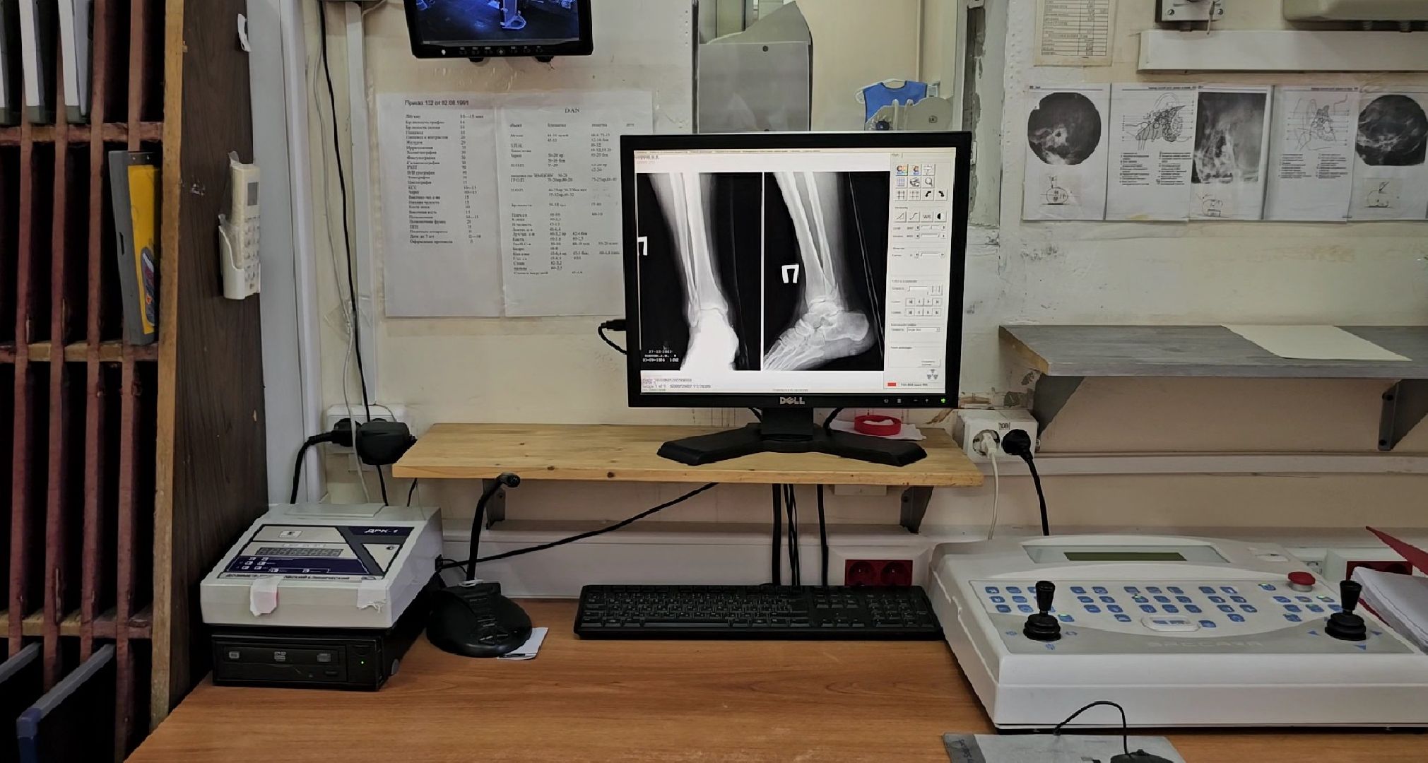 прямая линия, травматологическая помощь, здравоохранение подмосковья,