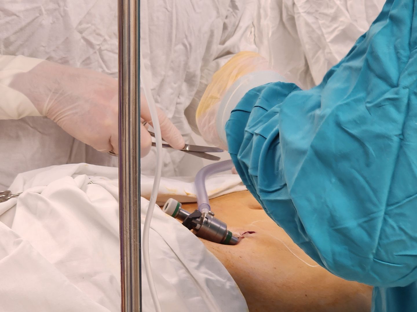 хирургия, малоинвазивные операции,