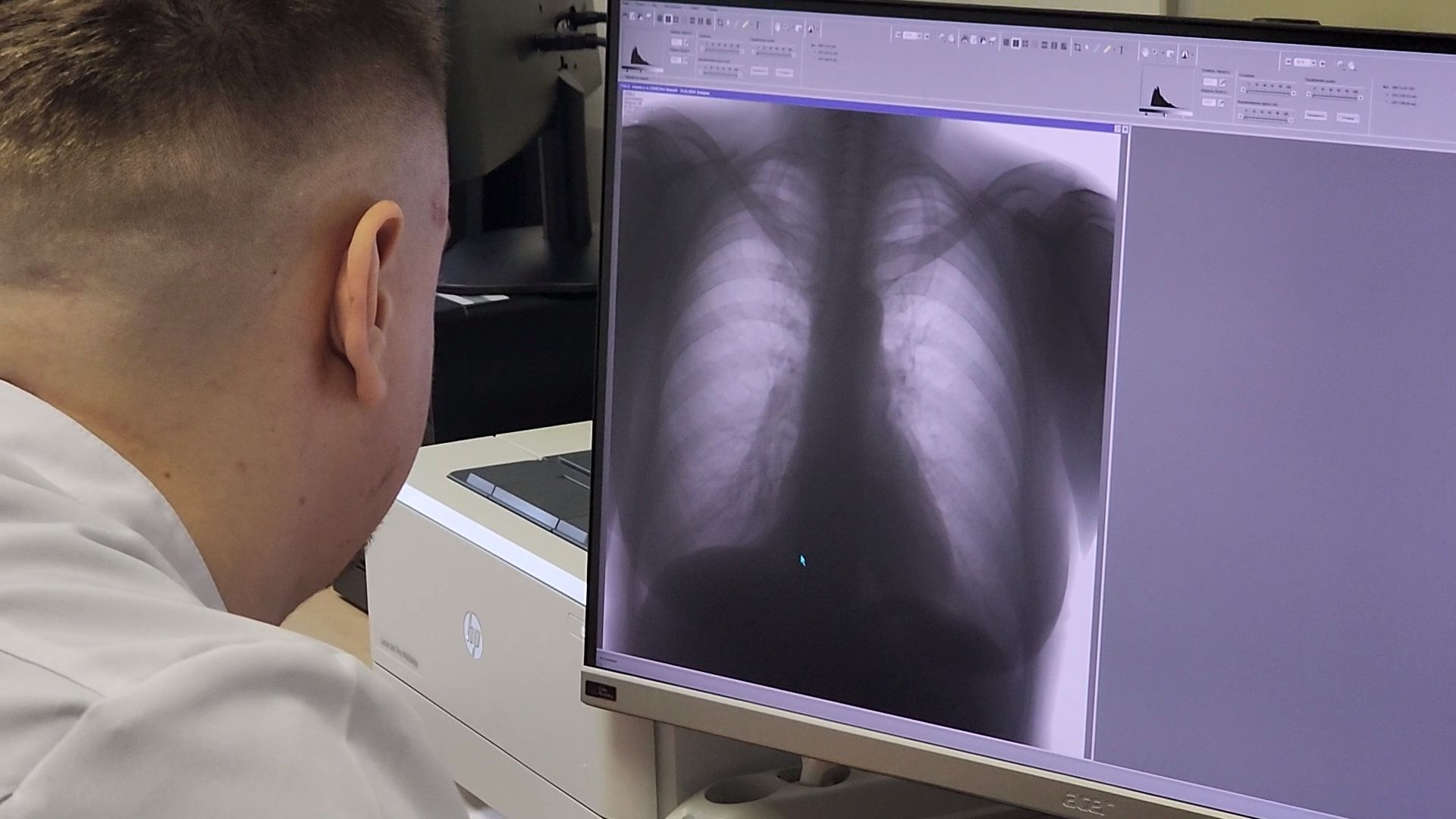 Дубна, Врач, Рентгенолог, Поликлиника, Дубненская больница,