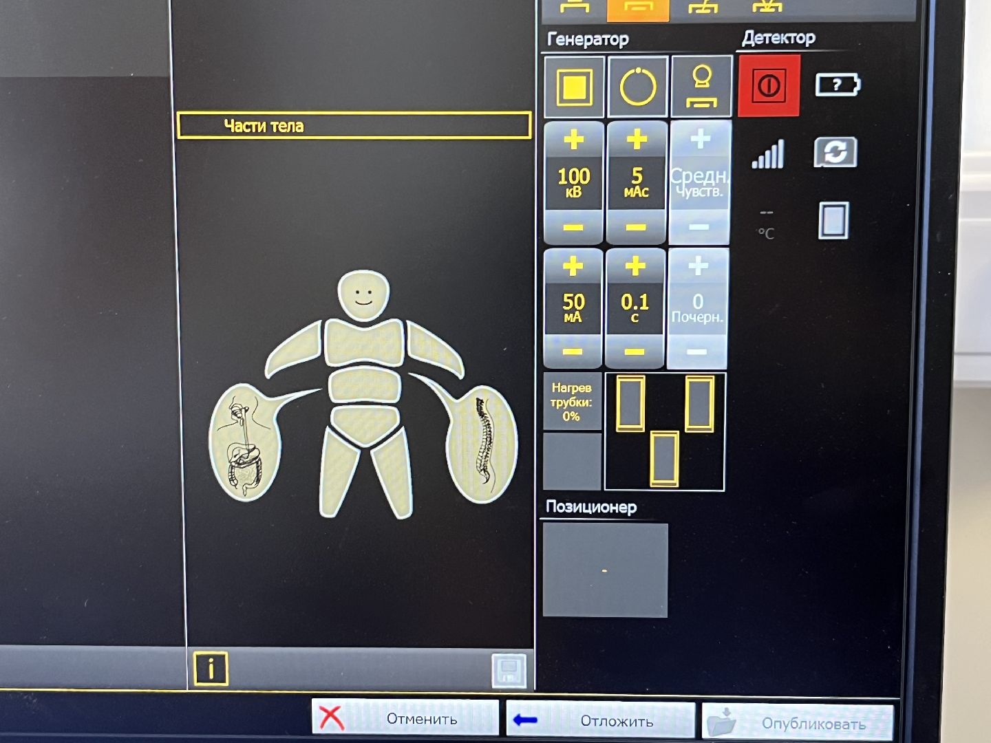 наро-фоминск, наро-фоминская областная больница, здравоохранение подмосковья, рентген-аппарат,
