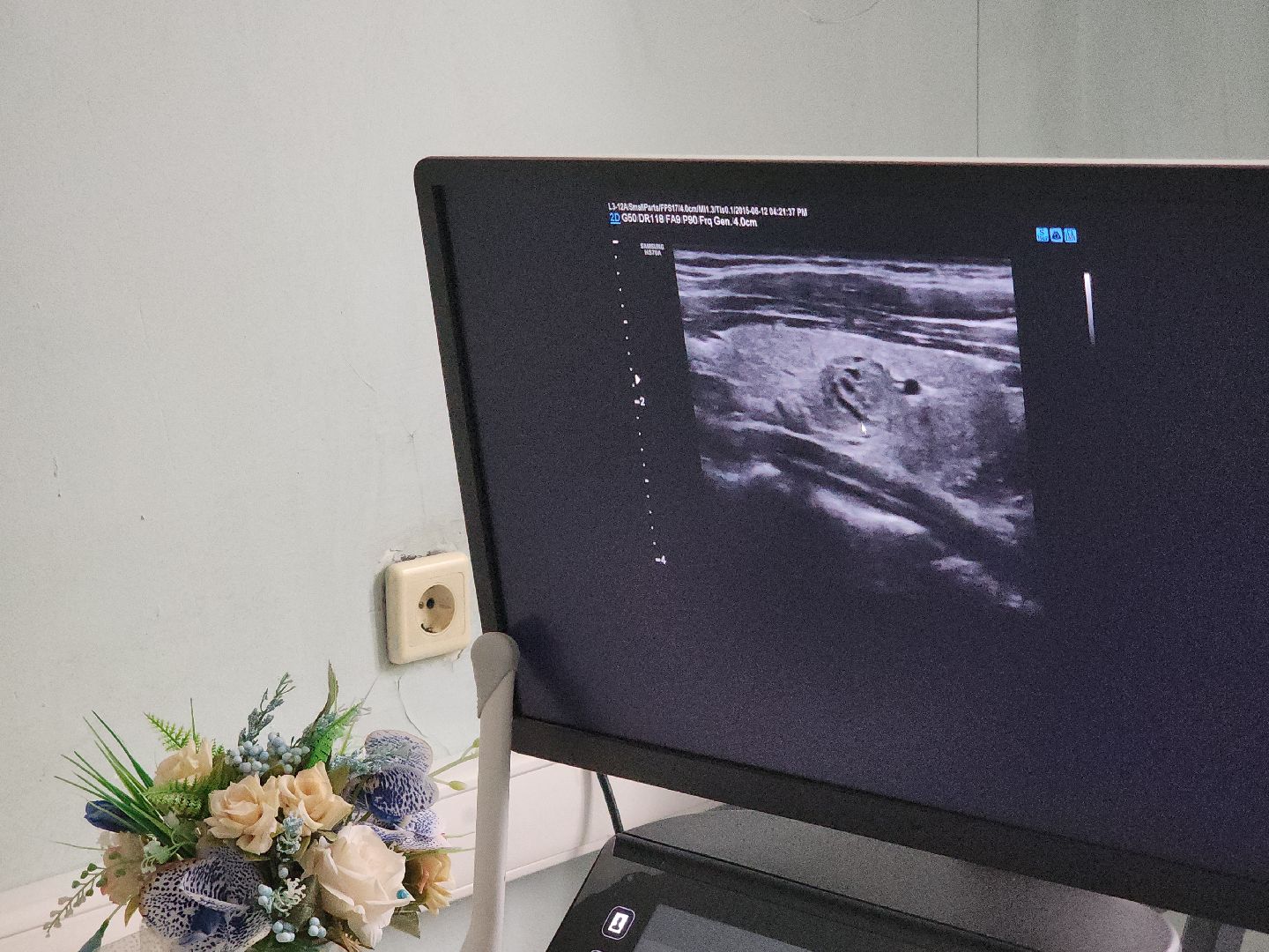 коломна, медицина, день борьбы против рака,