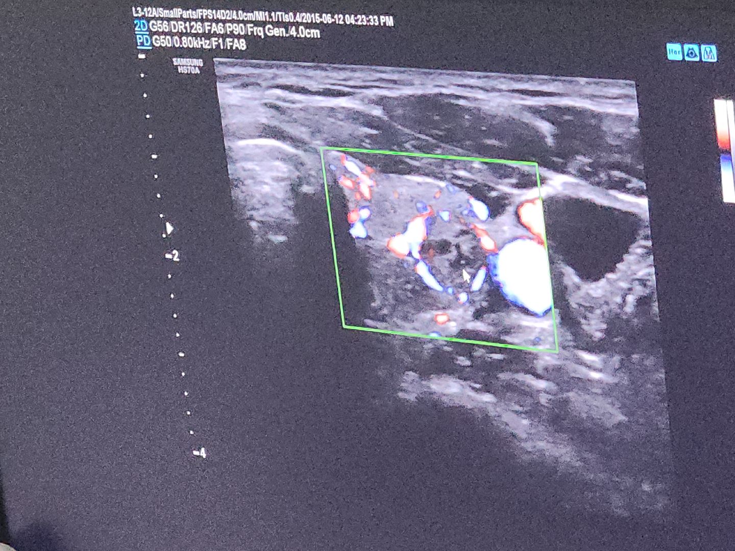 коломна, медицина, день борьбы против рака,