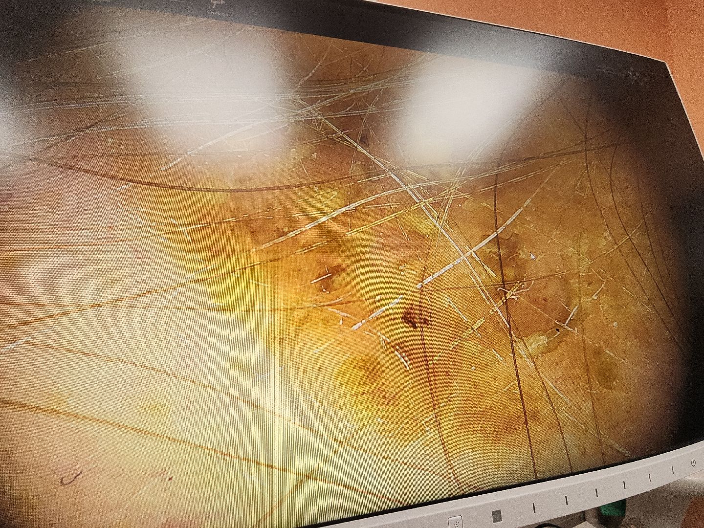 коломна, медицина, скриннинг рака кожи,