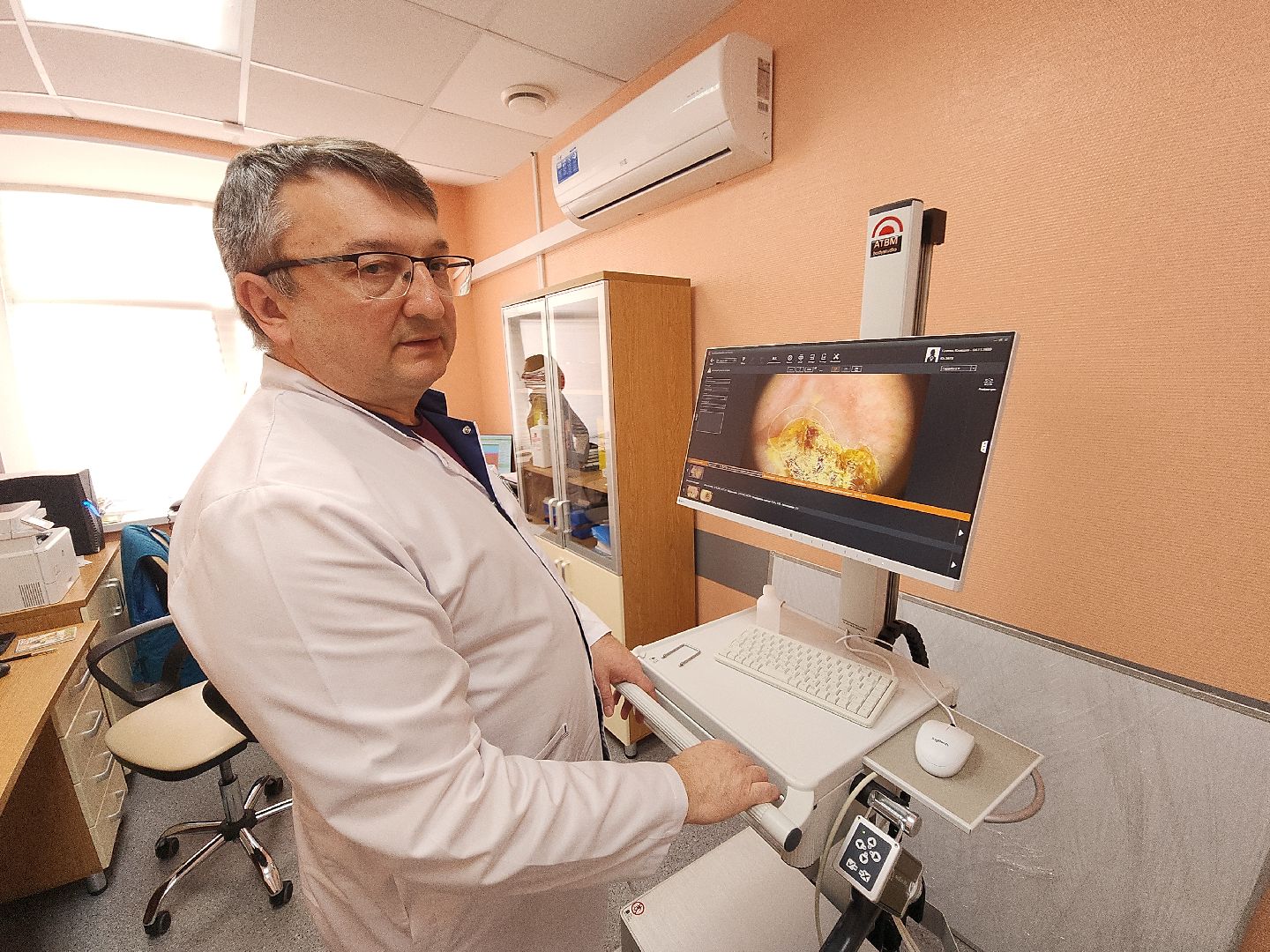 коломна, медицина, скриннинг рака кожи,