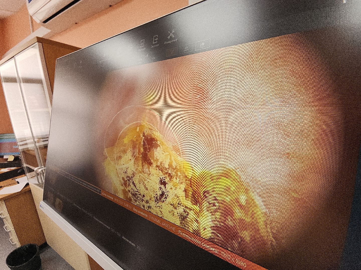 коломна, медицина, скриннинг рака кожи,