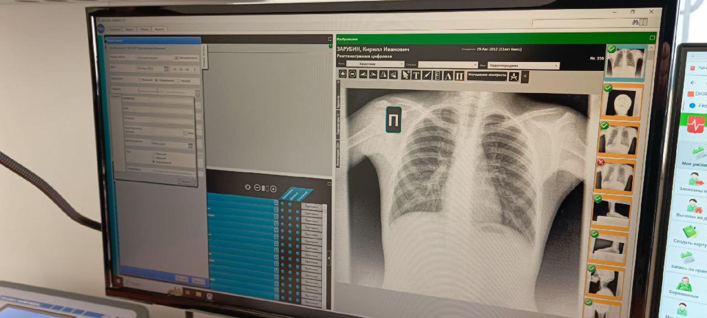 Дмитров, Дмитровская больница, Минздрав,