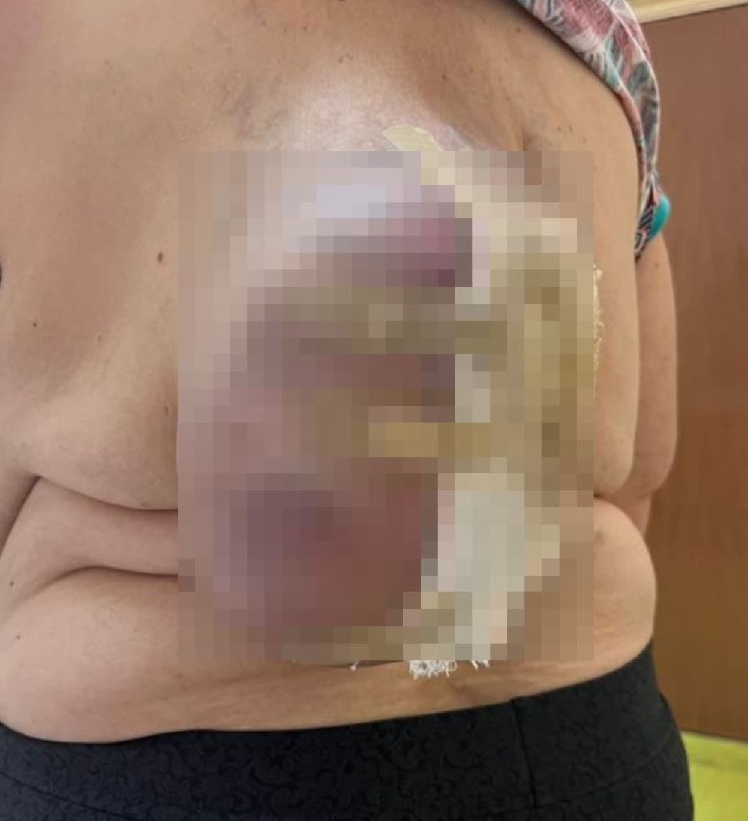 Балашиха, Подмосковье, медицинская помощь, Московский областной онкологический диспансер, рак, больницы