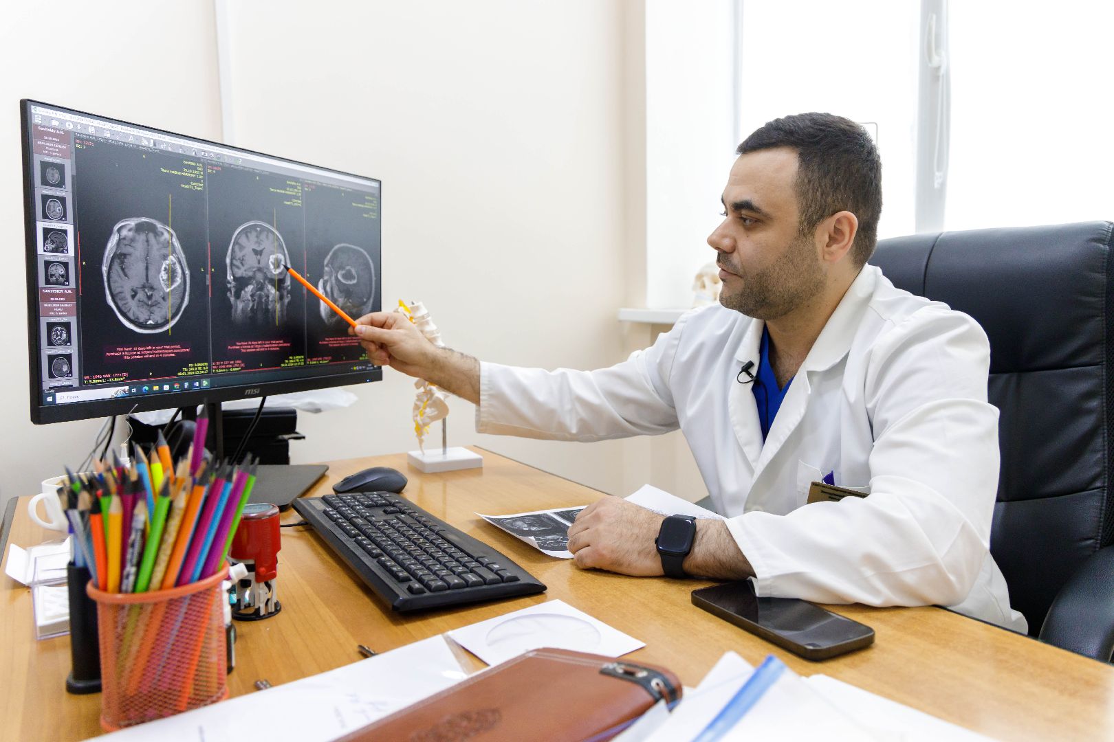 люберцы, люберецкая областная больница, нейрохирургия,