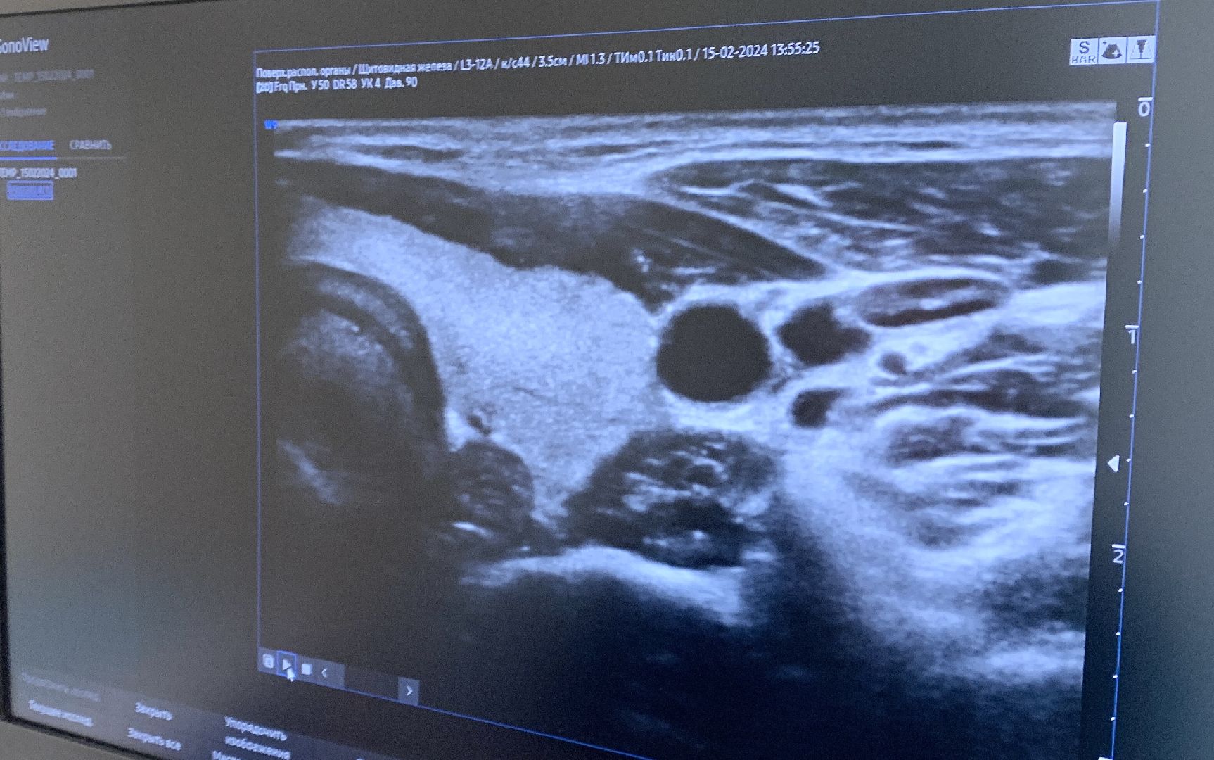 Балашиха, Подмосковье, цаоп, медицинское оборудование, здравоохранение подмосковья,