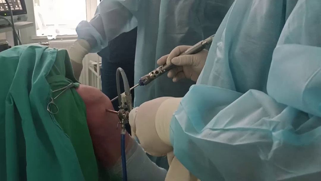 Пушкино, Пушкинский округ, медицина, операция, медики, областная больница, здравоохранение