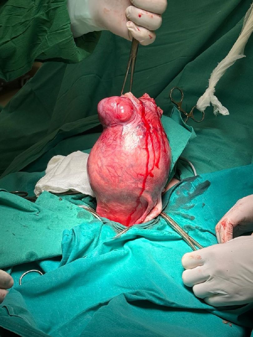 Бронницы, Бронницкая больница, Акушер-гинеколог, медицина подмосковья,