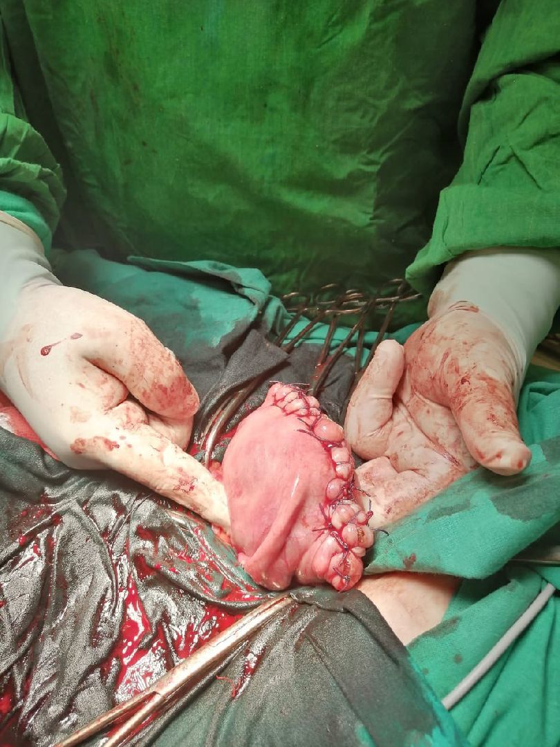 Бронницы, Бронницкая больница, Акушер-гинеколог, медицина подмосковья,