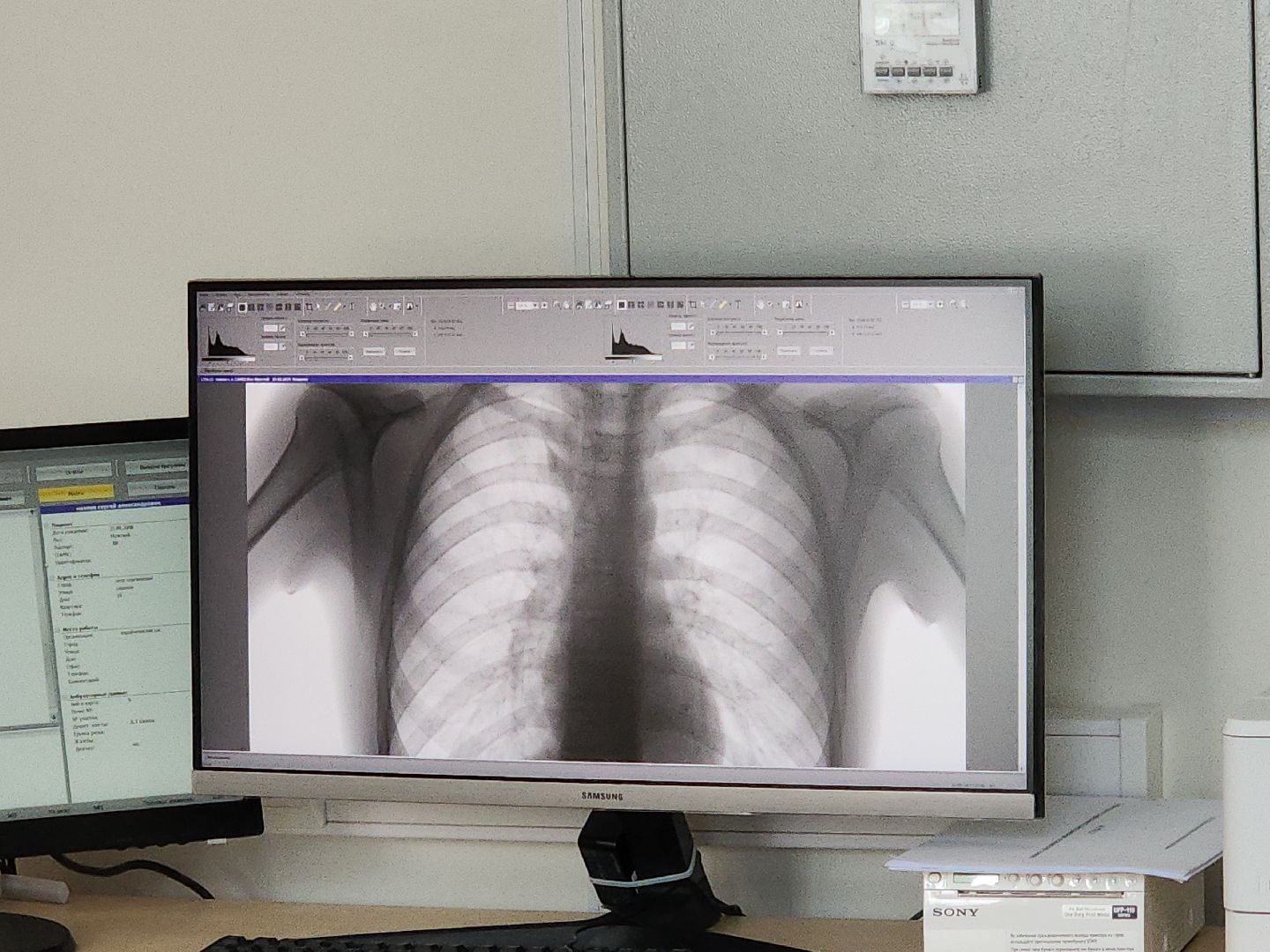 коломна, медицина, флюорограф,