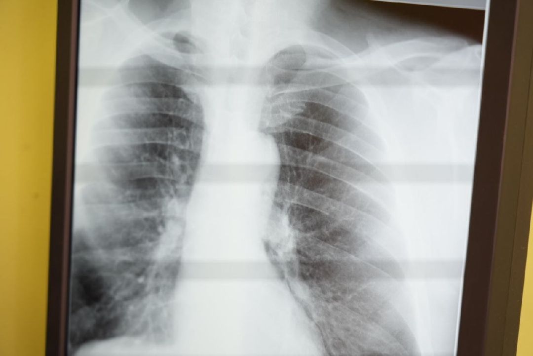 Сергиев Посад, Сергиево-Посадский городской округ, Медицина, Здравоохранение, Здоровье, Диспансеризация