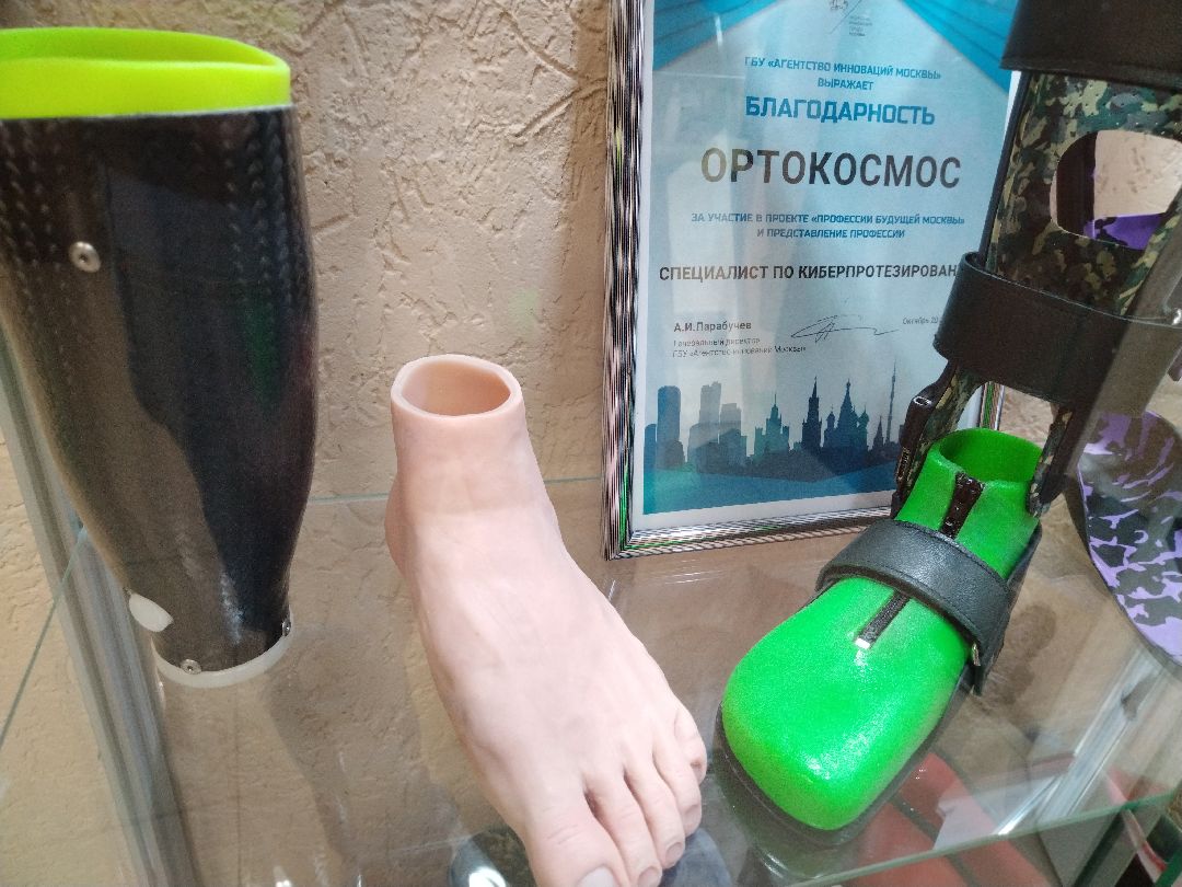Орто-Космос, Мытищи, протезы, ортезы, медицина, общество
