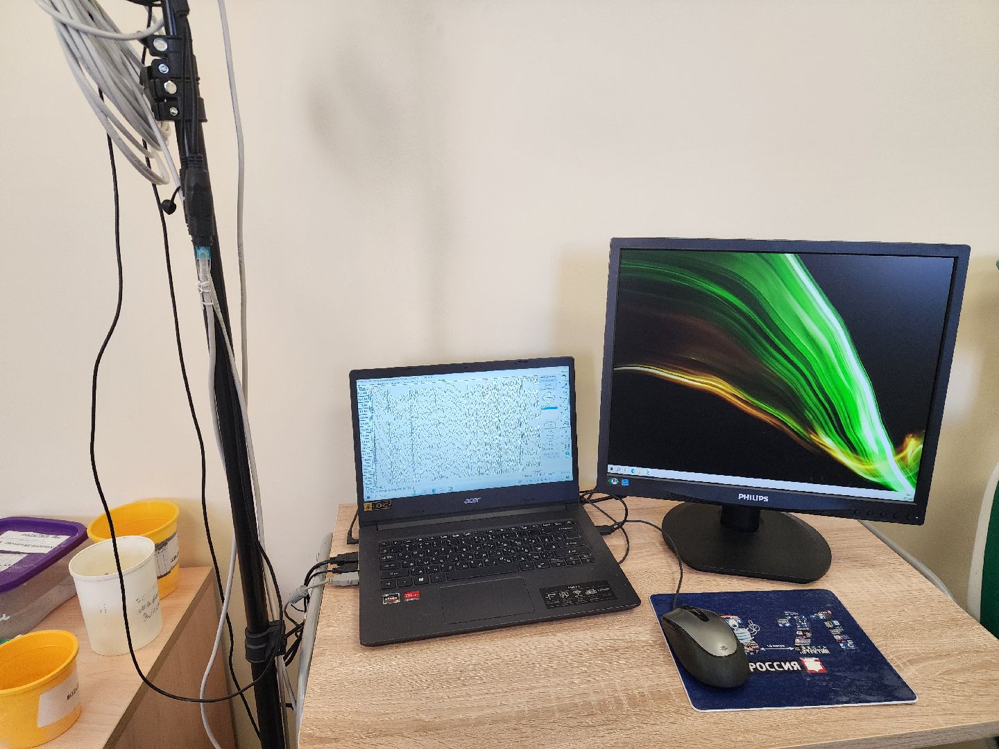 новый аппарат, диагностика,