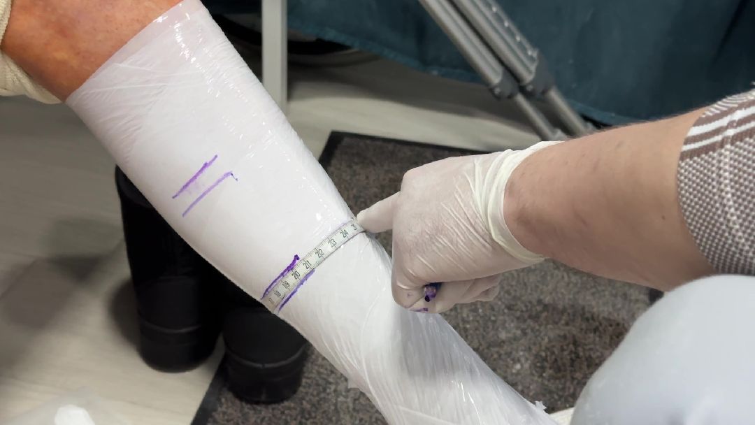 Реутов, протезы, СВО, военнослужащие, ампутация