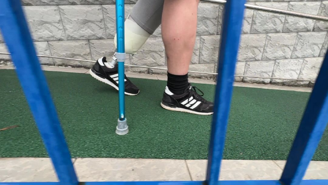 Реутов, протезы, СВО, военнослужащие, ампутация