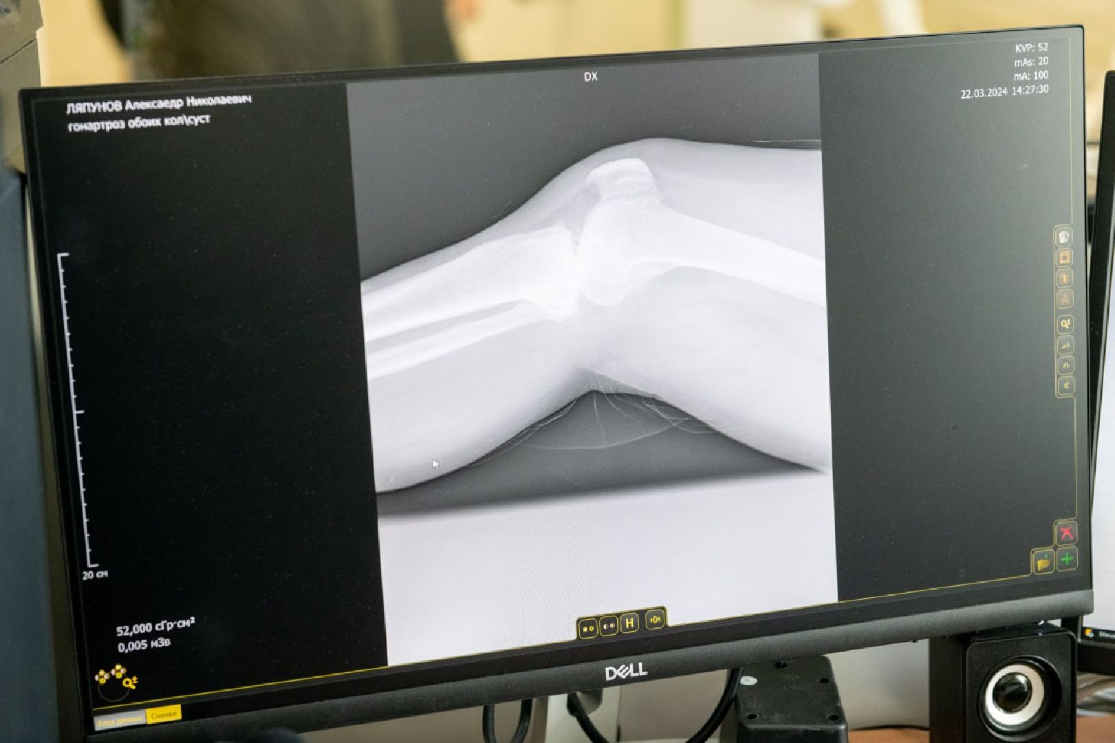 лыткарино, медицина, рентген-кабинет,