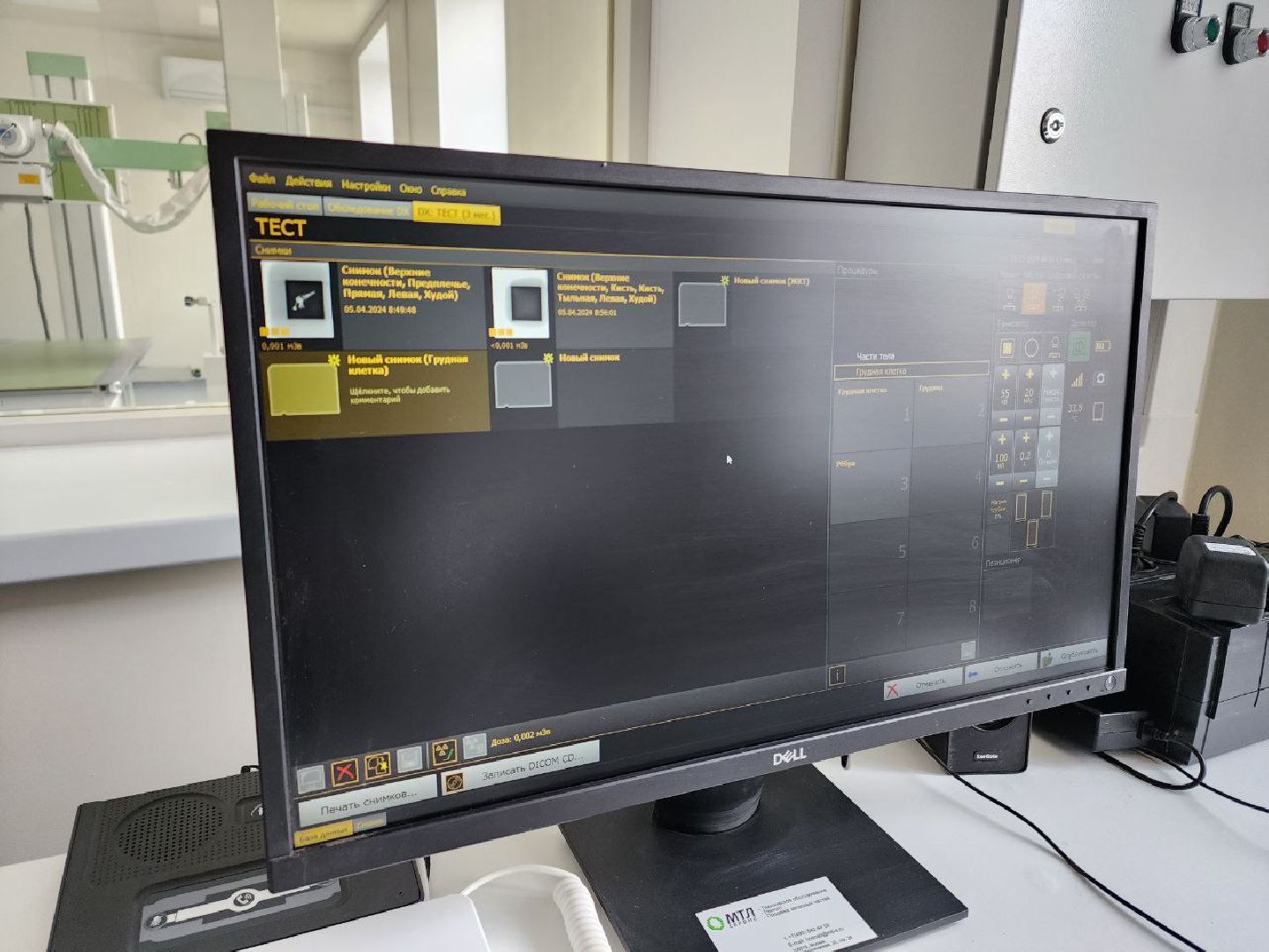 чехов, медицина, рентген-аппарат, цифровой рентген-аппарат, оборудование, больница,