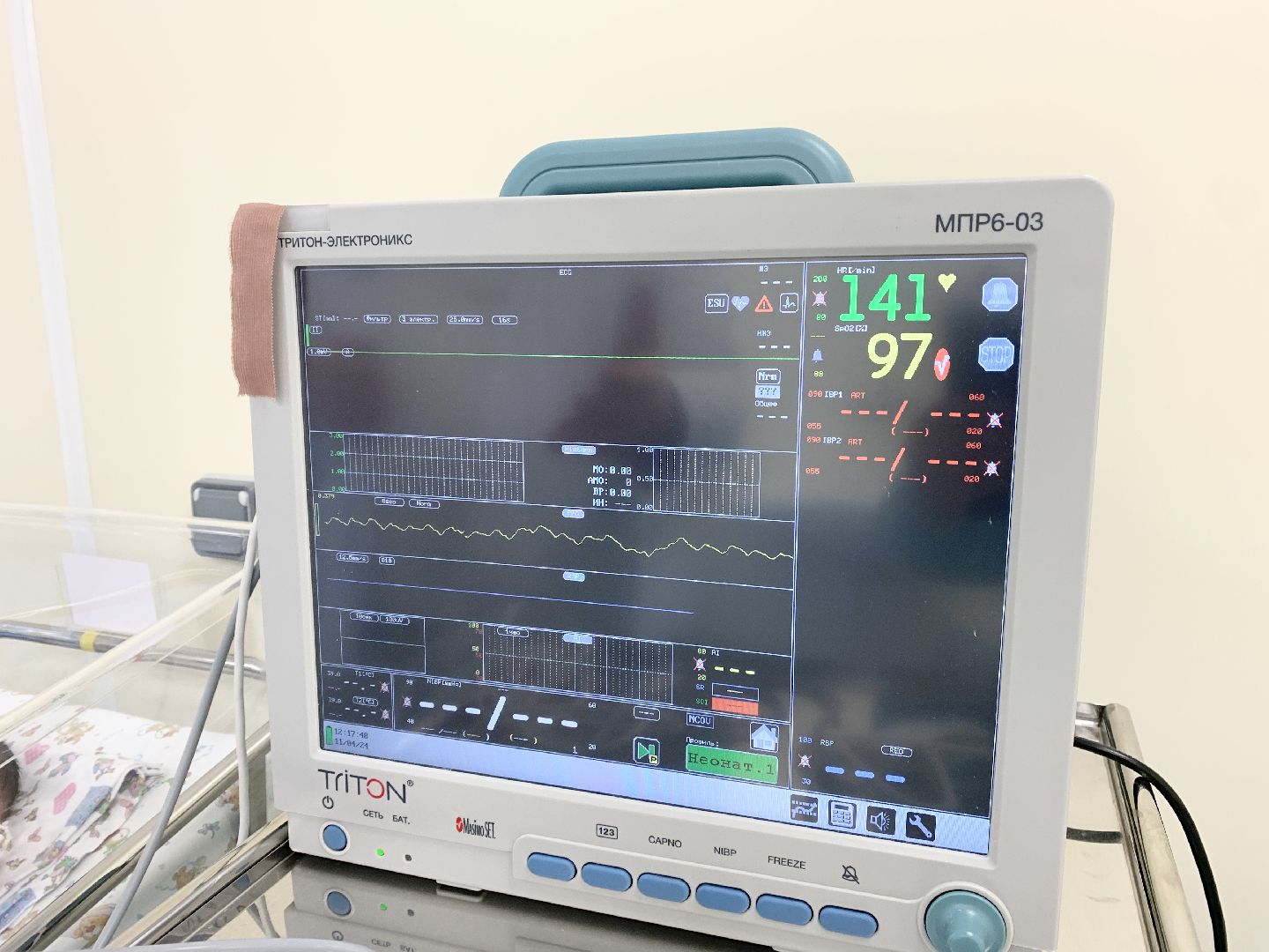 Балашиха, Подмосковье, Роддома, Кардиоскрининг новорожденным,