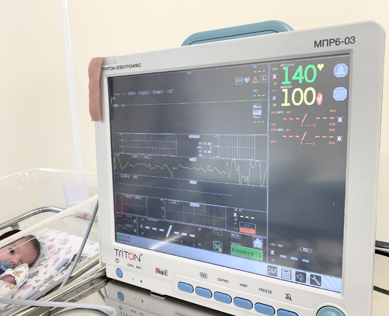 Балашиха, Подмосковье, Роддома, Кардиоскрининг новорожденным,