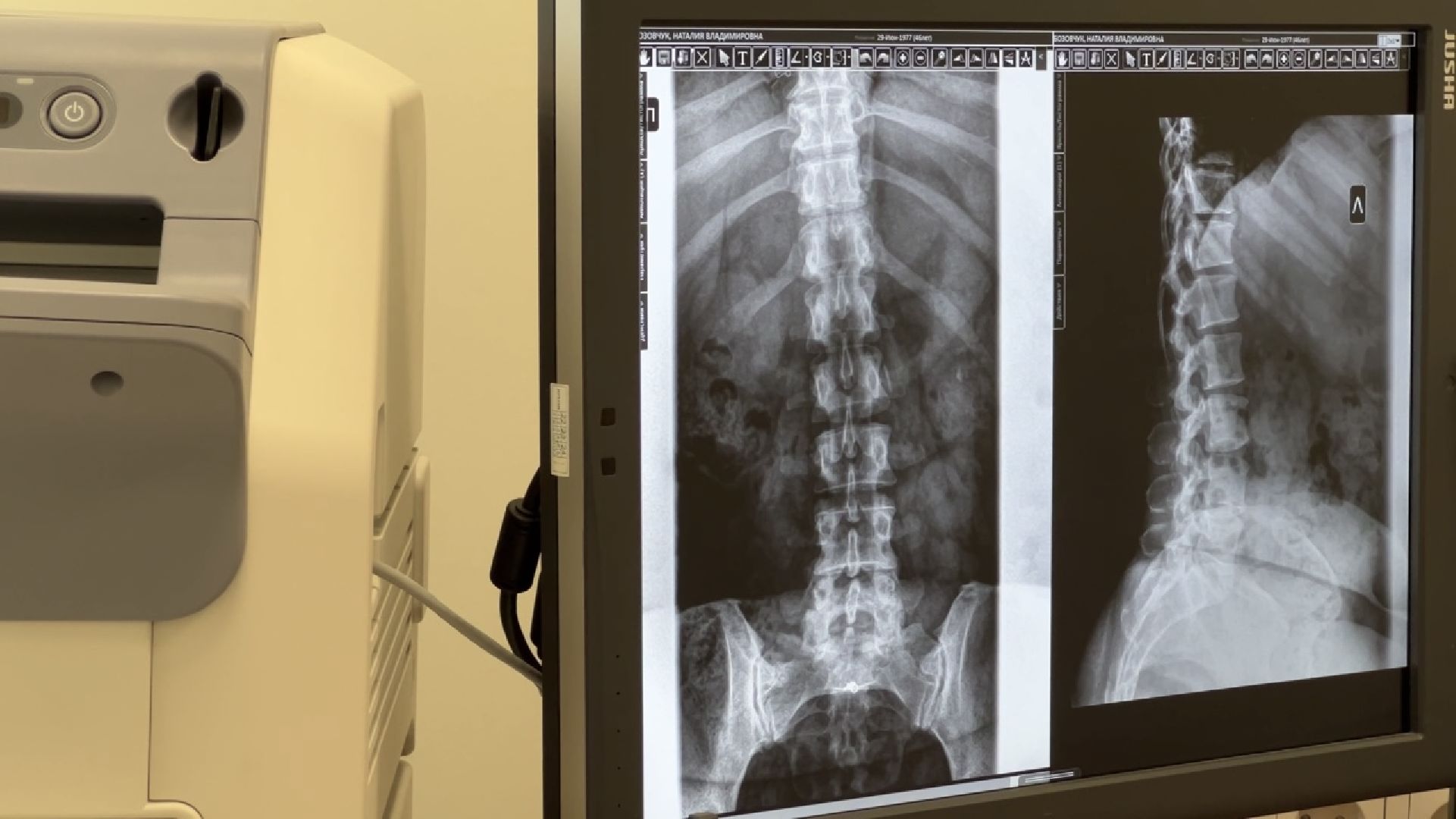 химки, медицина, поликлиника, рентген-аппарат, рентген-кабинет,