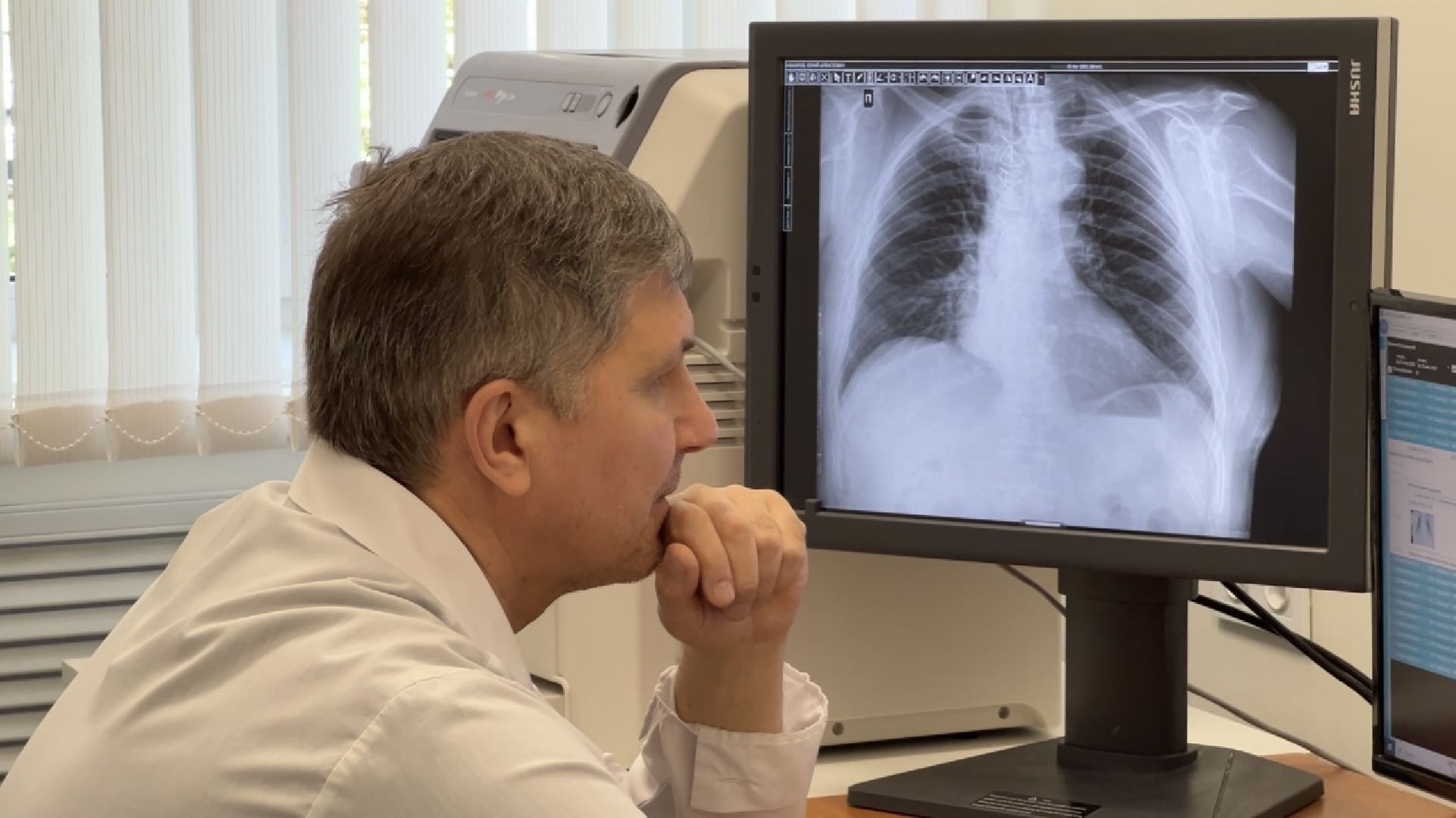 химки, медицина, поликлиника, рентген-аппарат, рентген-кабинет,