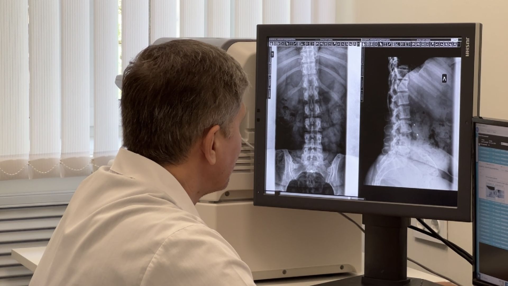 химки, медицина, поликлиника, рентген-аппарат, рентген-кабинет,