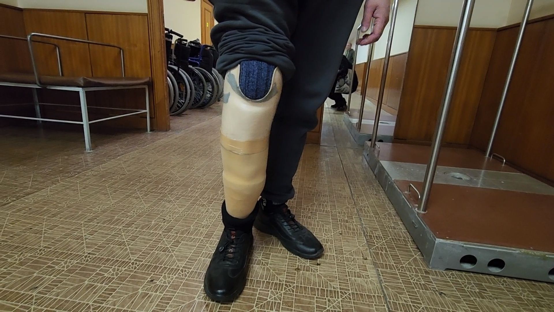 руза, можайск, цвт им. лиходея, протезирование, реабилитация,