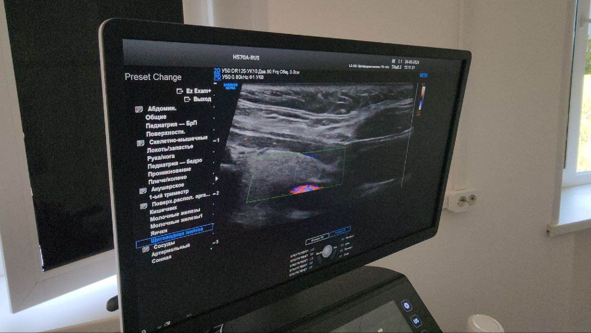 узи, малаховка, новый врач, поликлиника,