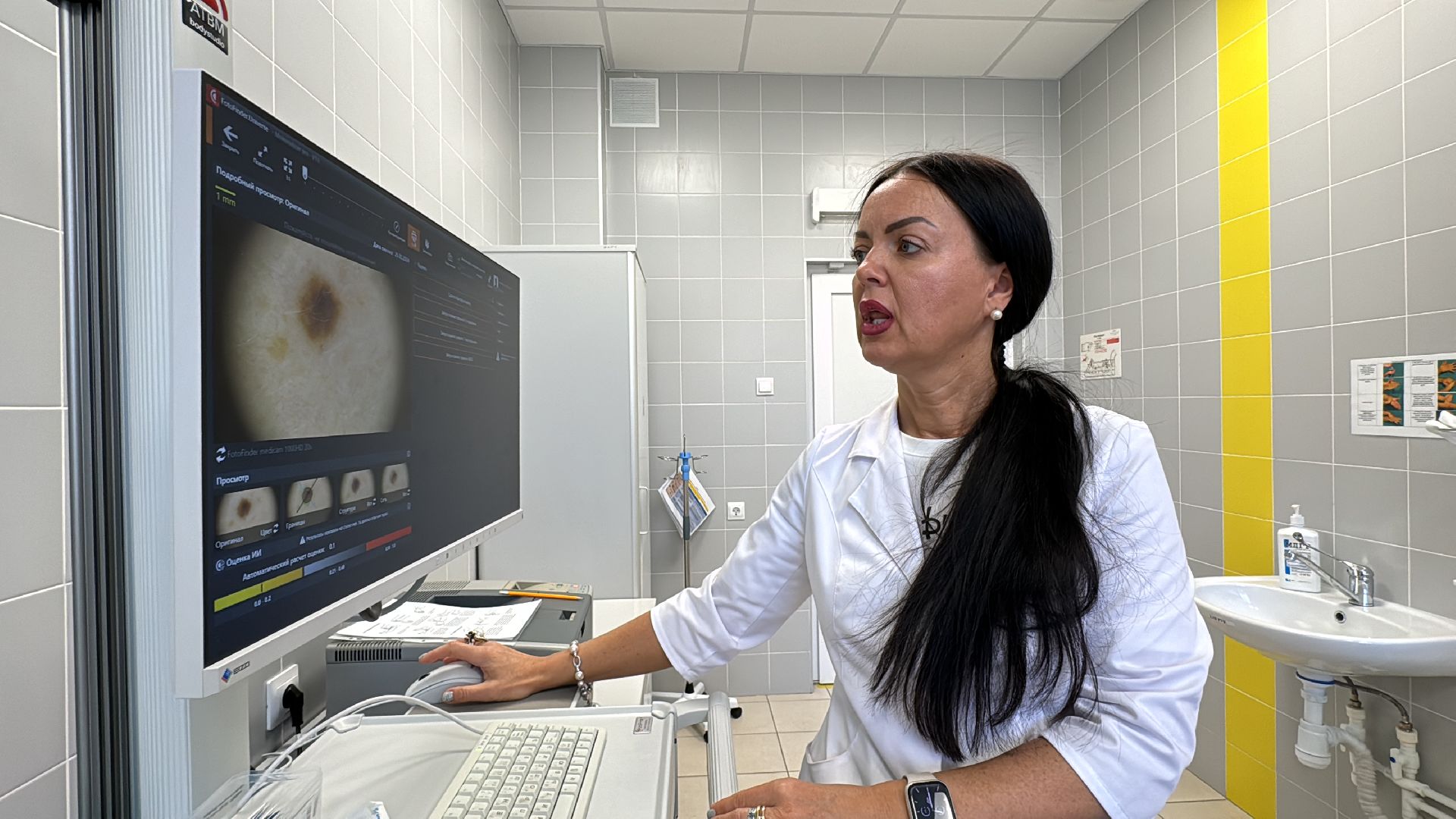 Одинцово, здравоохранение подмосковья, Меланома кожи,