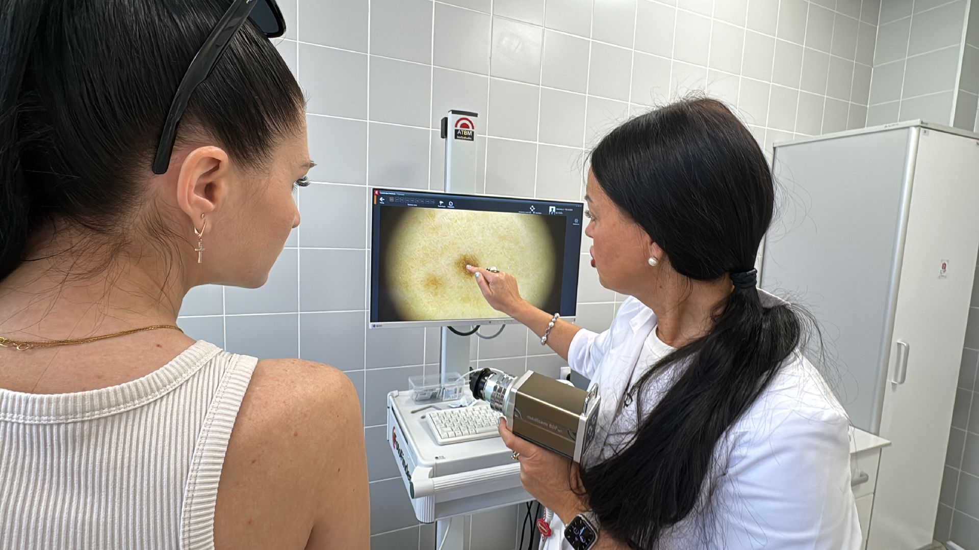 Одинцово, здравоохранение подмосковья, Меланома кожи,