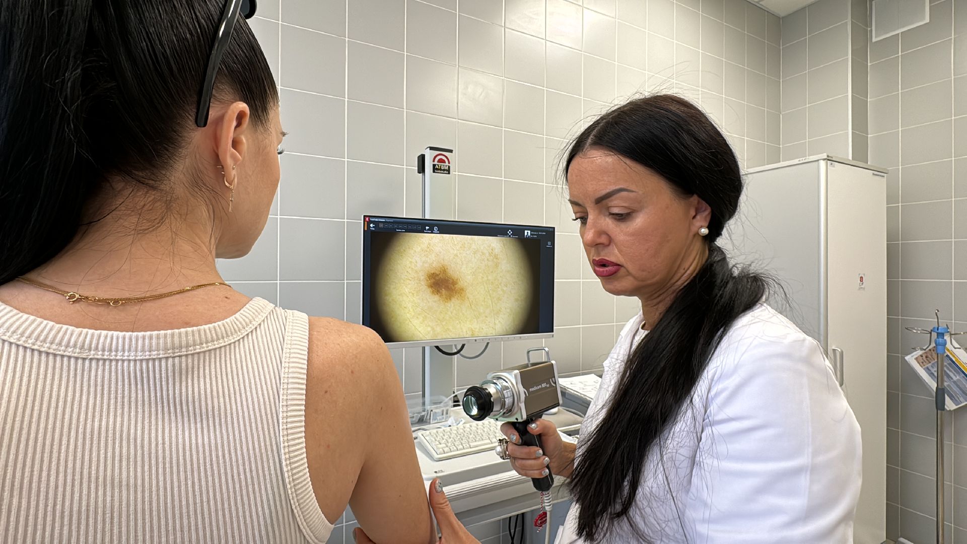 Одинцово, здравоохранение подмосковья, Меланома кожи,