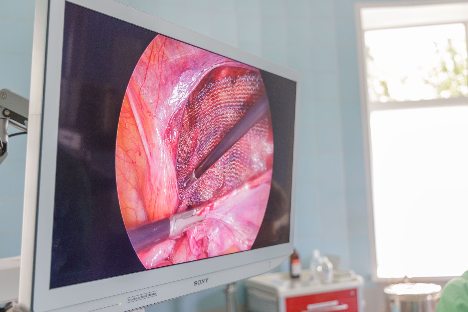 люберцы, хирургическое отделение, люберецкая областная больница,