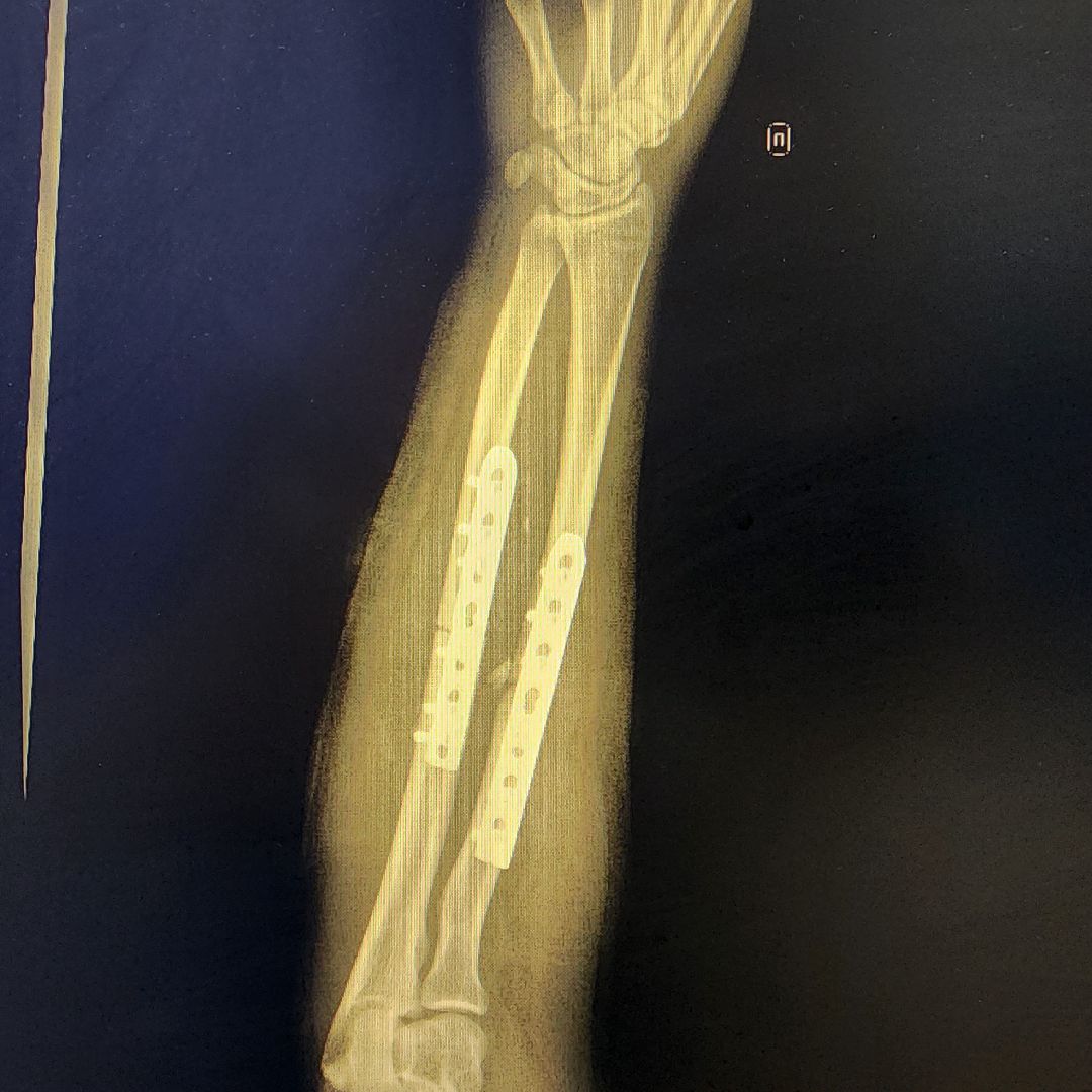 Солнечногорск, медицина, травматология, история спасения,