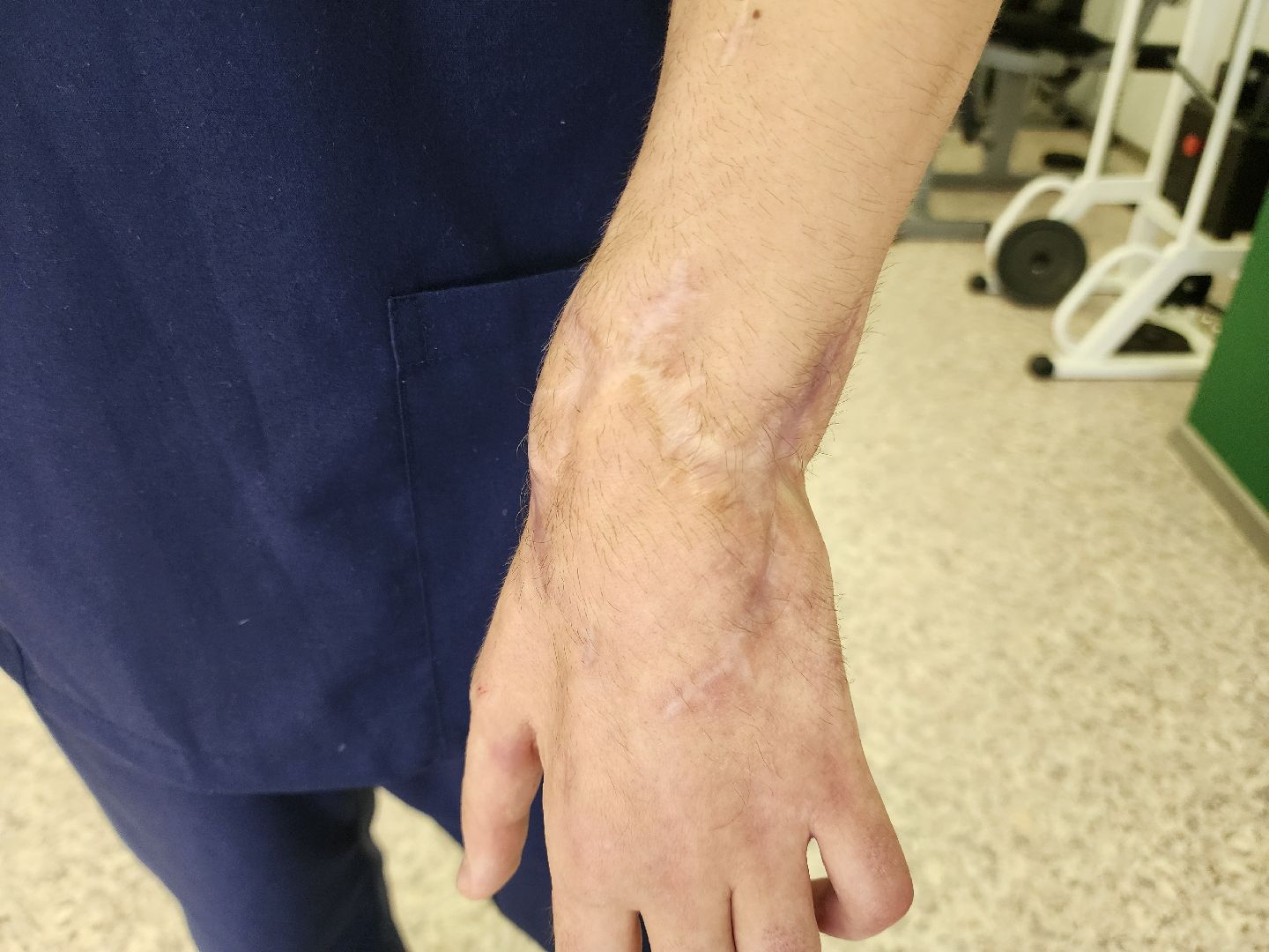 Подольск, Ясенки, Сво, реабилитация участников сво,