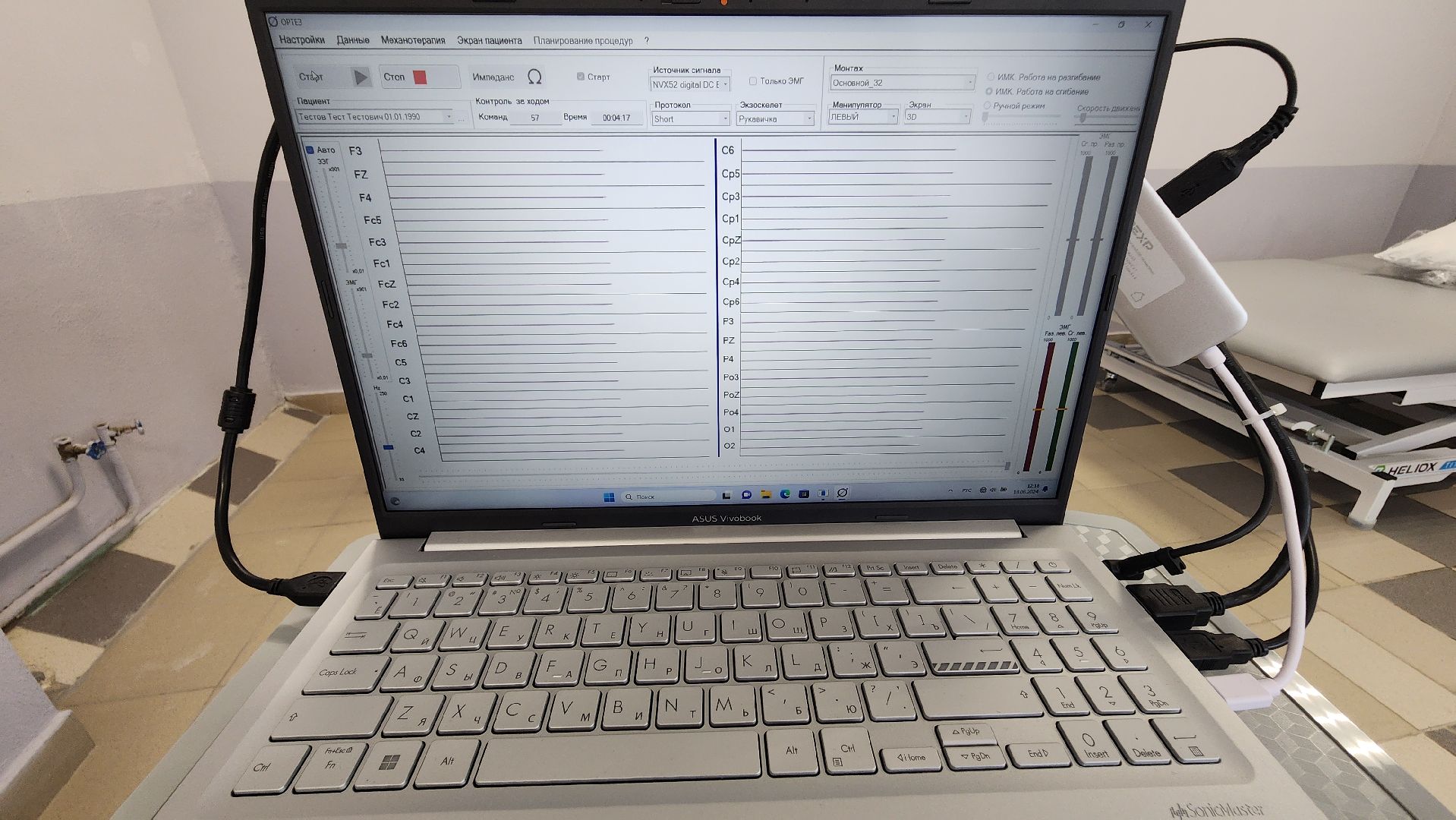 Солнечногорск, медицина, реабилитация, новое оборудование, здравоохранение подмосковья,