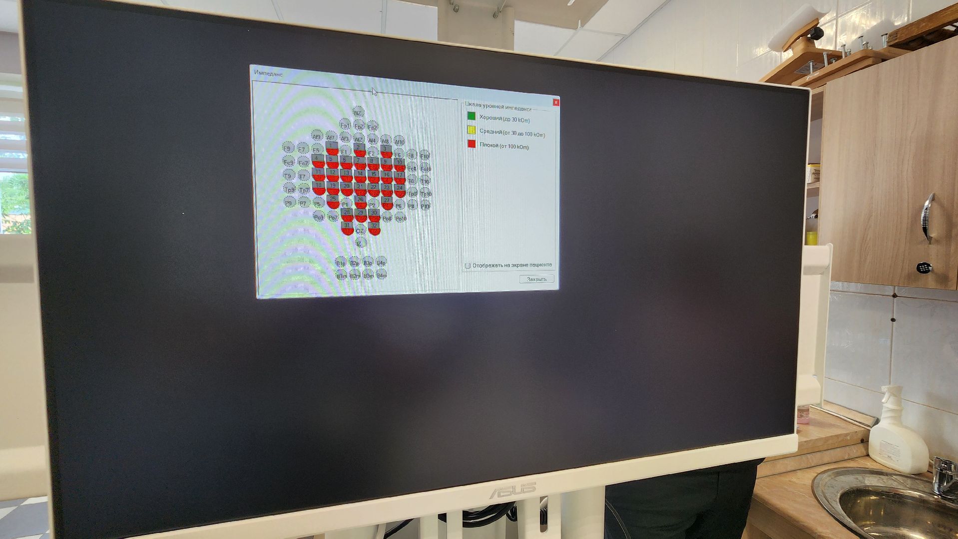 Солнечногорск, медицина, реабилитация, новое оборудование, здравоохранение подмосковья,