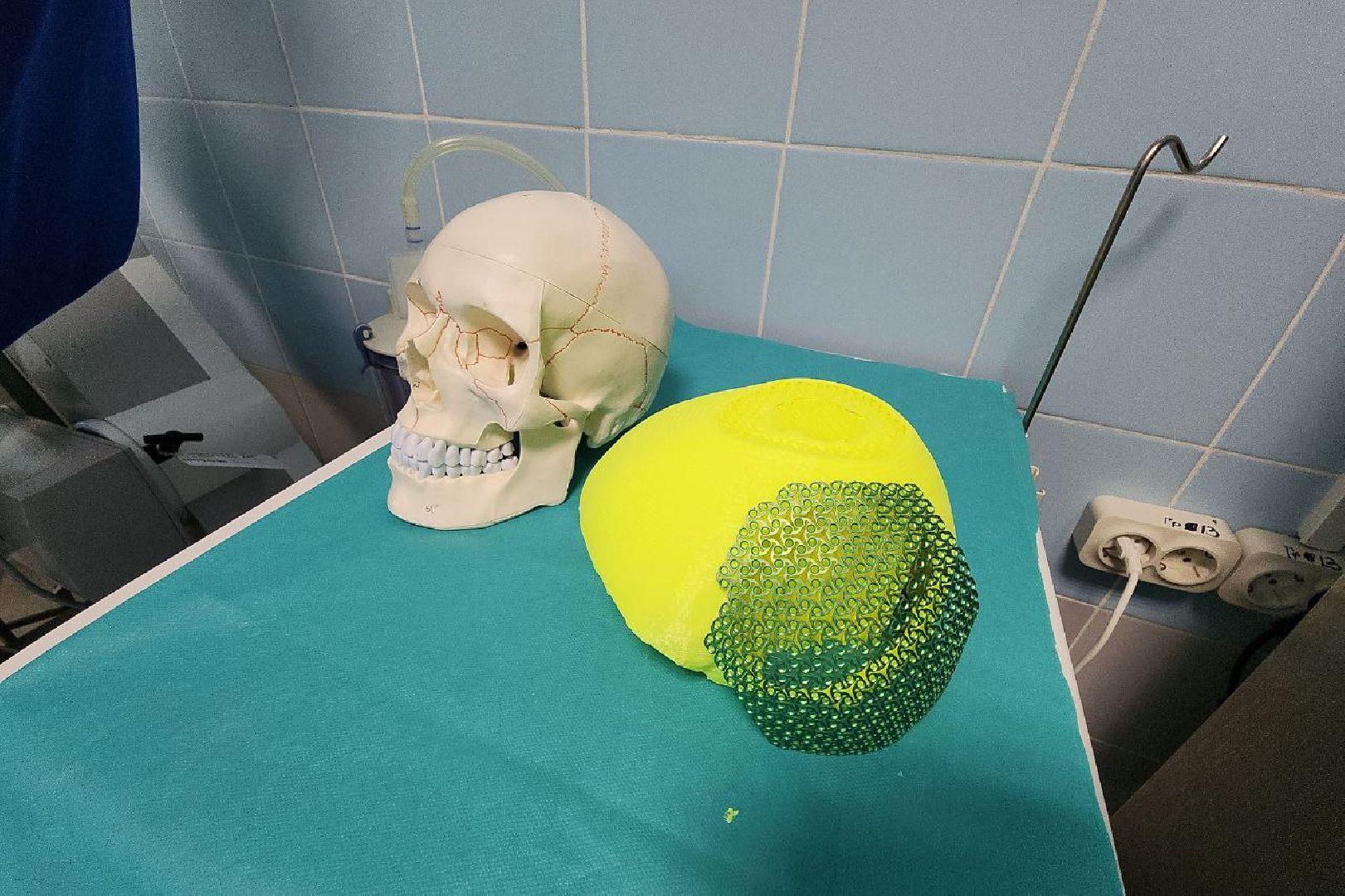 Люберцы, хирурги, имплант,