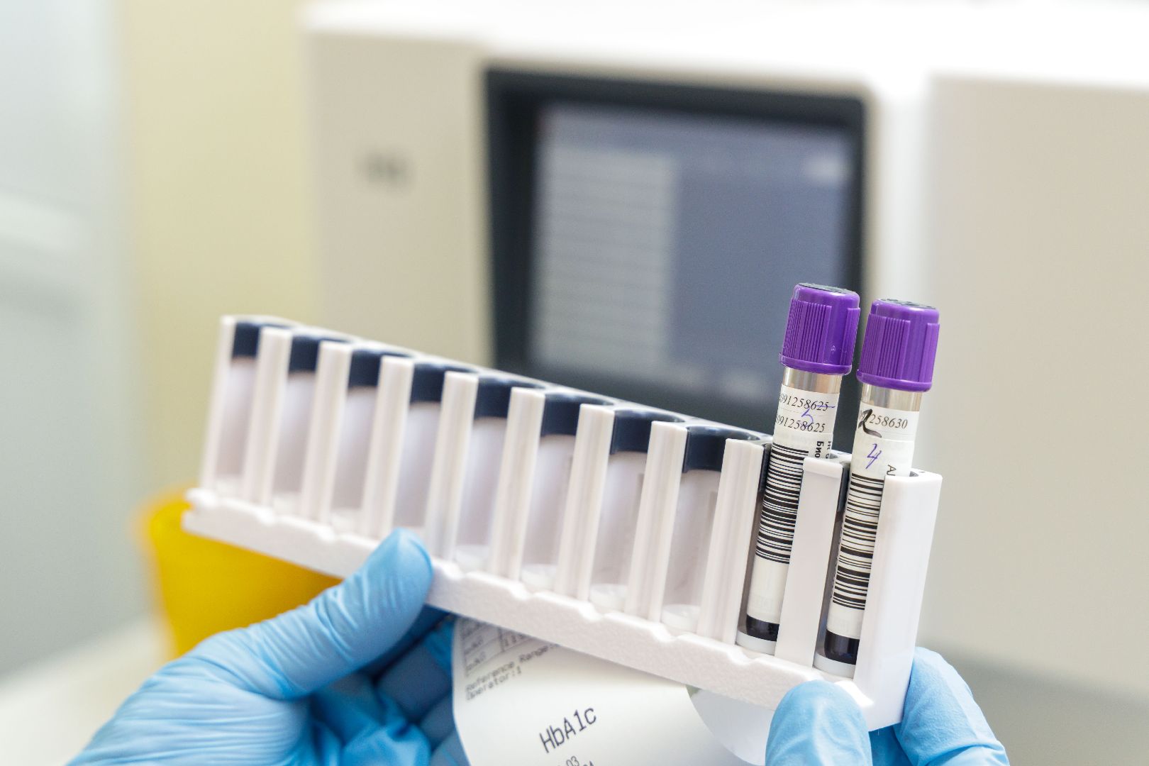 Люберцы, Люберецкая областная больница, лаборатория,